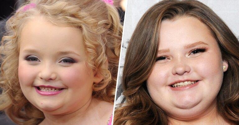 Weight-Loss Surgery: What Honey Boo Boo, And Everyone, Gets Wrong About It