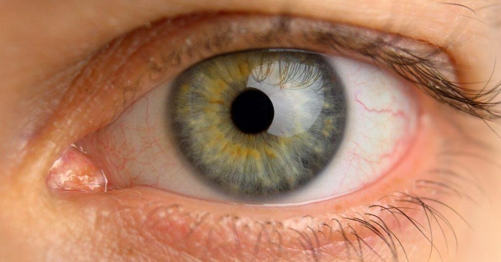 When Your Eyes Can Reveal If You Have Heart Disease…