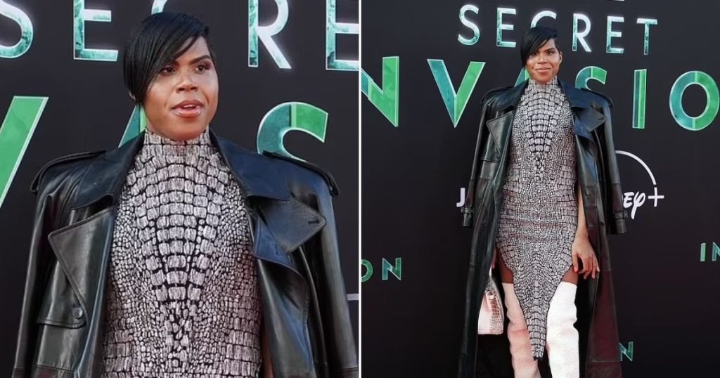 Magic Johnson’s Son Dazzles In High Heels And Sparkling Dress After Dramatic Weight Loss